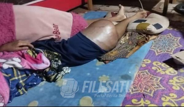 Selva Nurfajriah, usia 14 tahun sudah cukup lama mengalami sakit serius